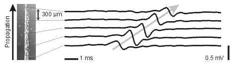 cardiac cell